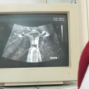 自由国医院B超奇葩剧情视频1部978M太离谱